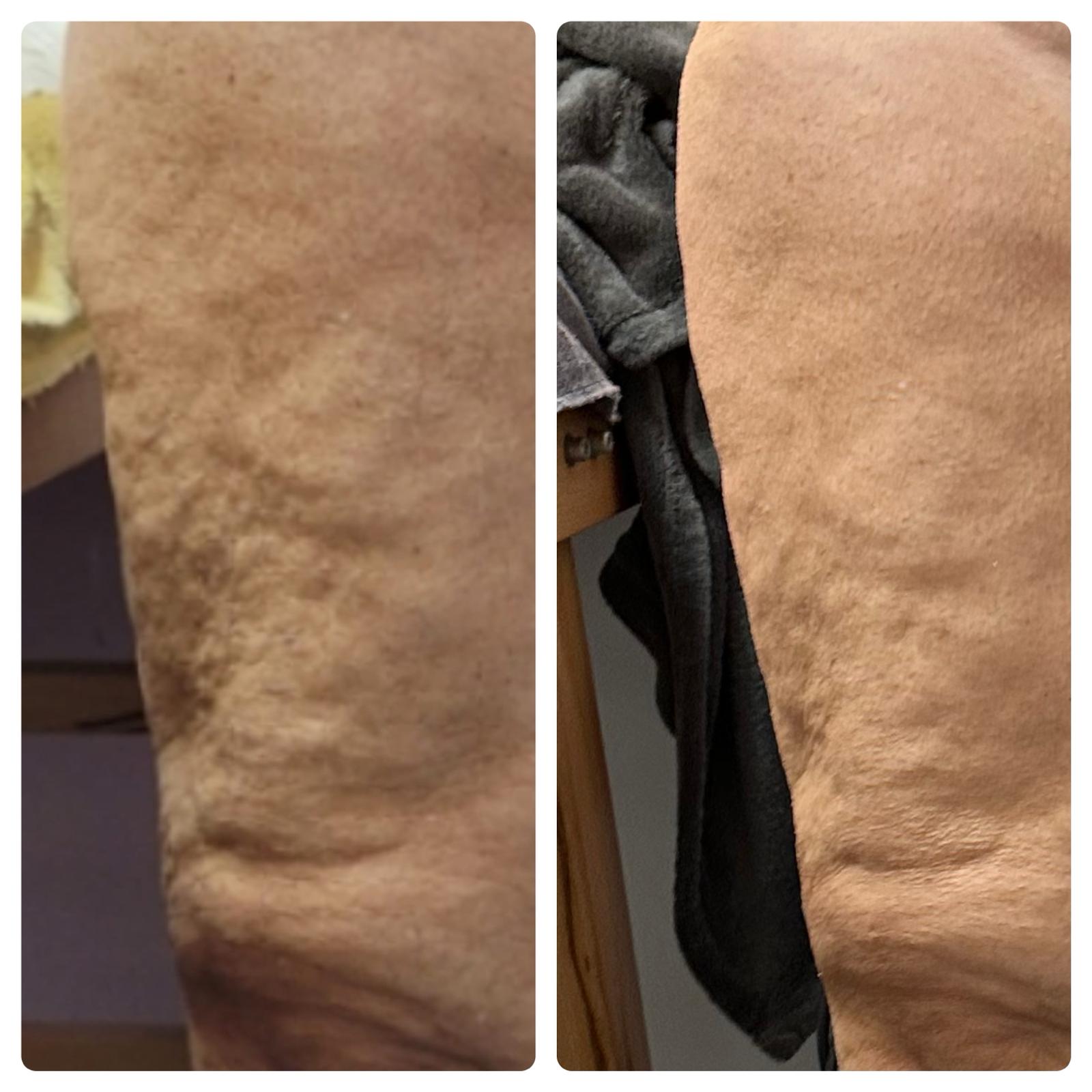Shape 4 Plus gambe