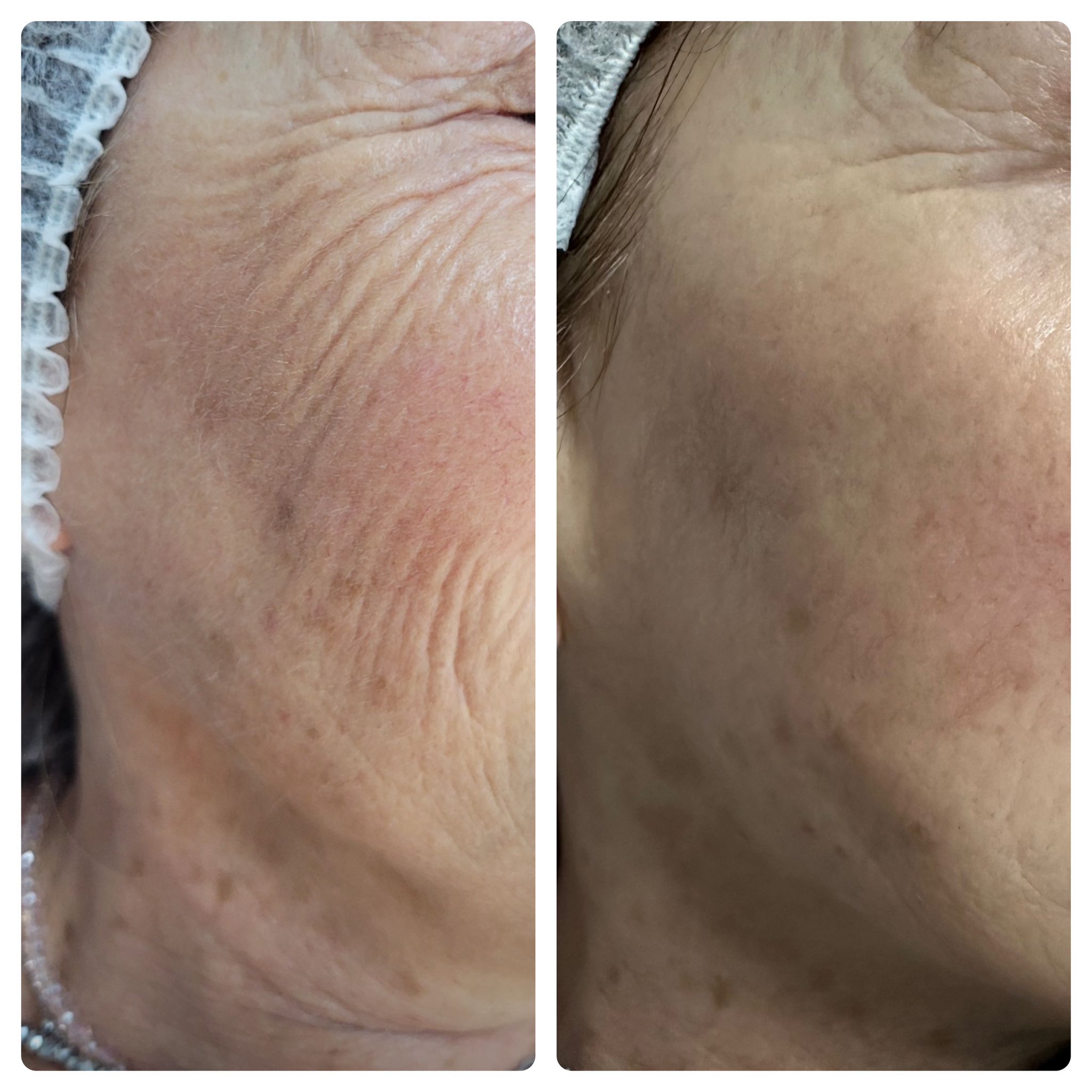 Shape 4 Plus viso